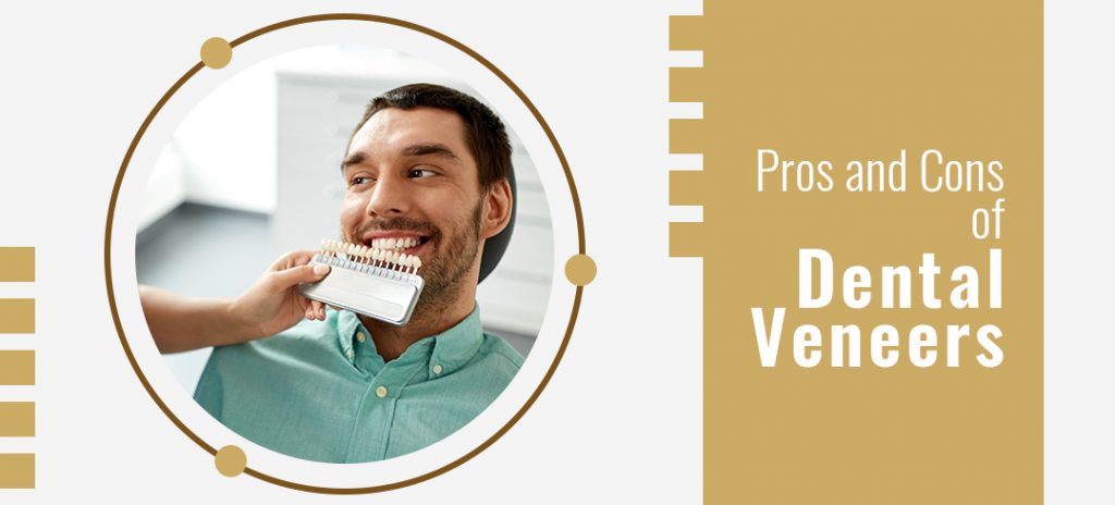 Dental Veneers