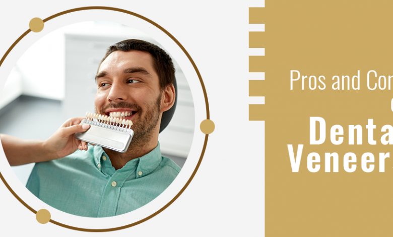 Dental Veneers