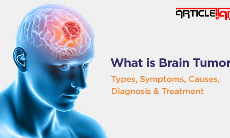 what is brain tumor